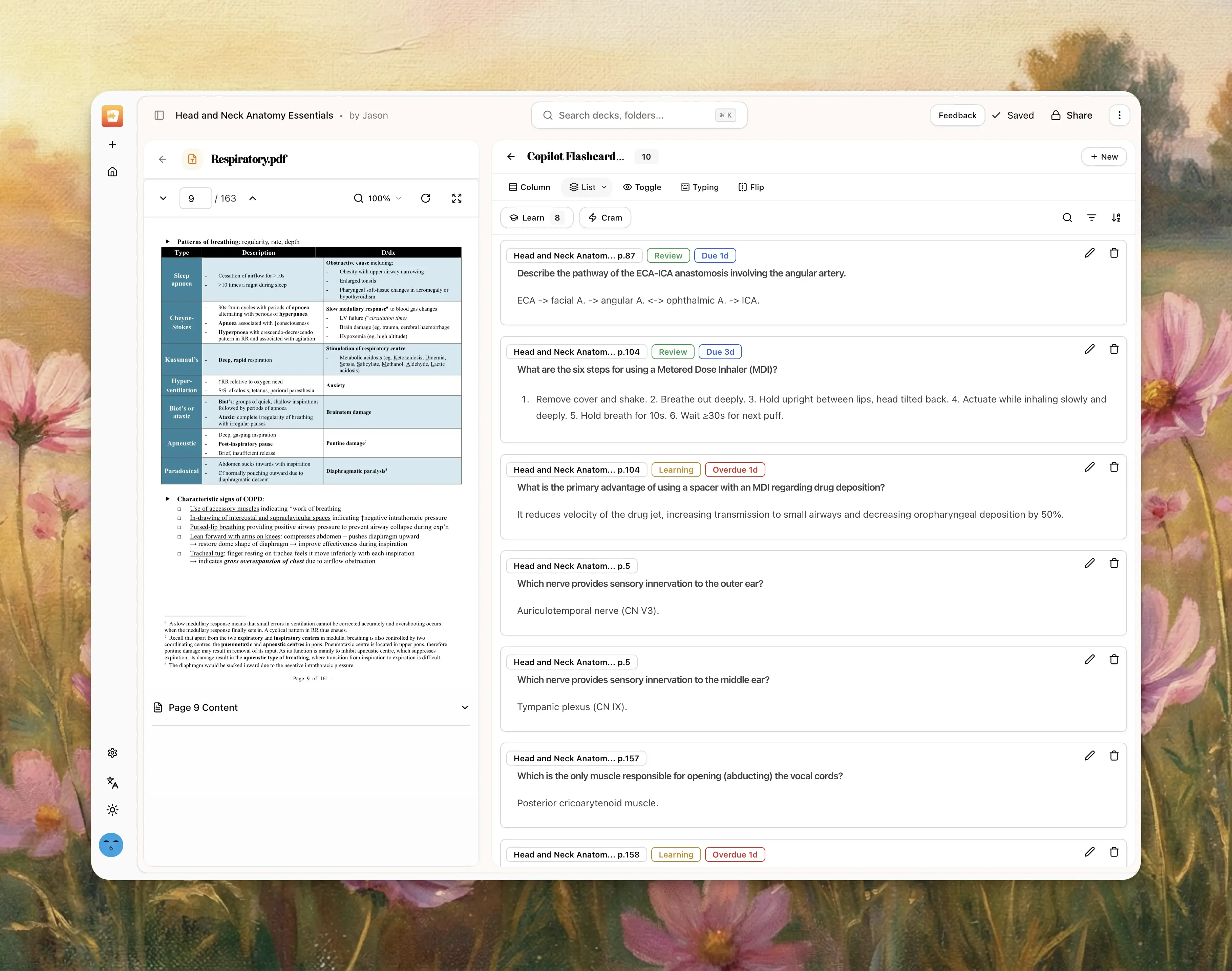 Recreate the Classic Layout in Memo V8